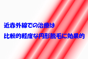 円形脱毛部位に赤外線を照射するスーパーライザー療法で発毛根拠を示す