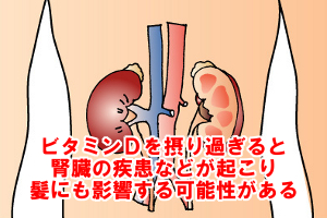 ビタミンＤ過剰摂取による症状｜腎臓機能低下で脱毛も起こりうる