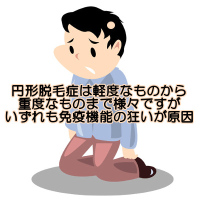 円形脱毛症の原因は遺伝要素が大きい｜生える可能性は０ではない