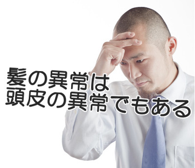 はげる予兆は頭皮の状態だけでも複数確認できるので不安な場合一度チェックしてみましょう