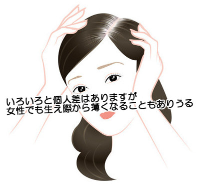 おでこの生え際の両側が…m字に剃り込みが入るのは女でもありえる？