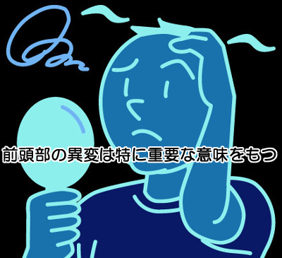 前髪が薄くなってきたのならＡＧＡを発症している可能性があるのでこれからの生活を改める必要があります