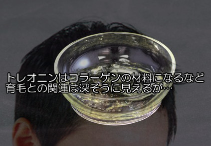 トレオニンと育毛の関係｜コラーゲンの材料のようですが…