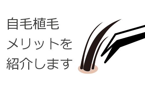 自毛植毛の優れたメリット メンテ要らずで髪が生え続ける