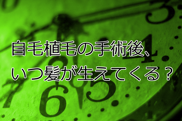 自毛植毛の術後経過について 結果が実感しやすいのは１年後