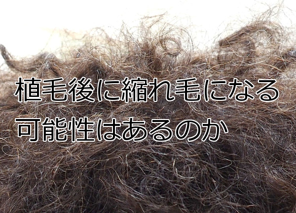 植毛と縮れ毛の関係 大半は１年ほどで元に戻りますが…