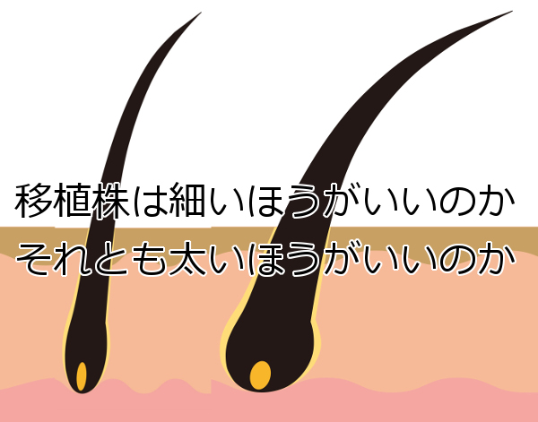 植毛株は大きい方が定着が良い？ チャビィVSスキニー