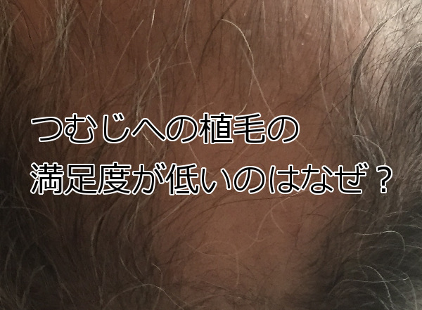 つむじ付近の植毛は満足度が低い傾向にあるようですが…