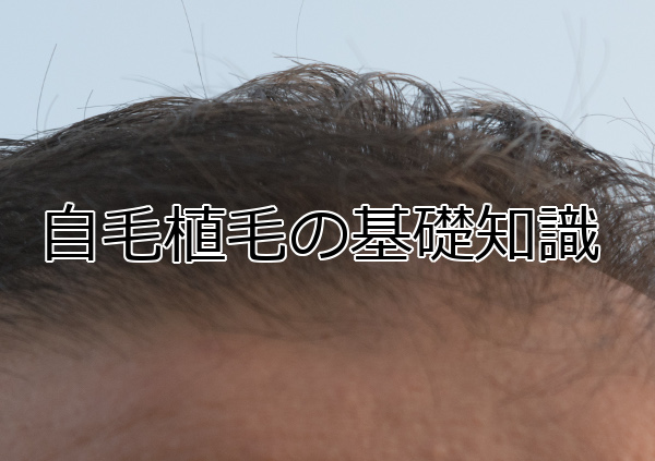 自毛植毛とは？ メリット以外にも知っておくべきこと一覧