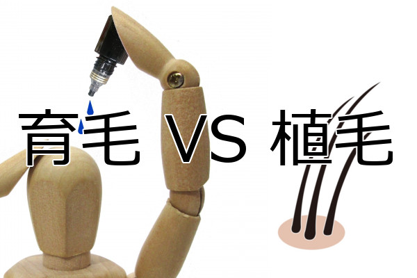 植毛 VS 育毛　両者の違いからどちらの方が良いかを考察