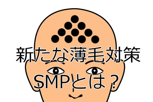 SMPとは？ あたかも髪の毛が生えているように見せる技術