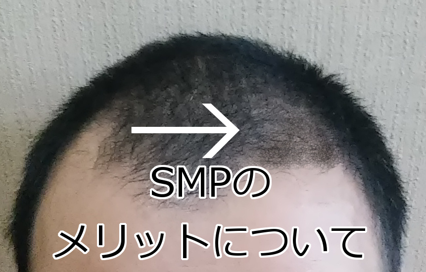 SMPのメリット