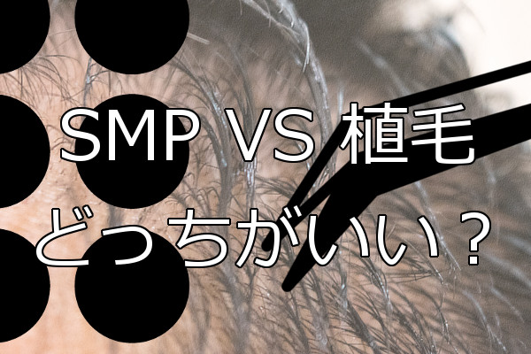 SMPと植毛はどちらがいいか 状況による向き不向きを考察